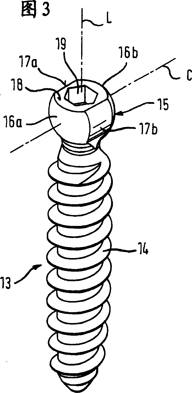 Bone anchoring device