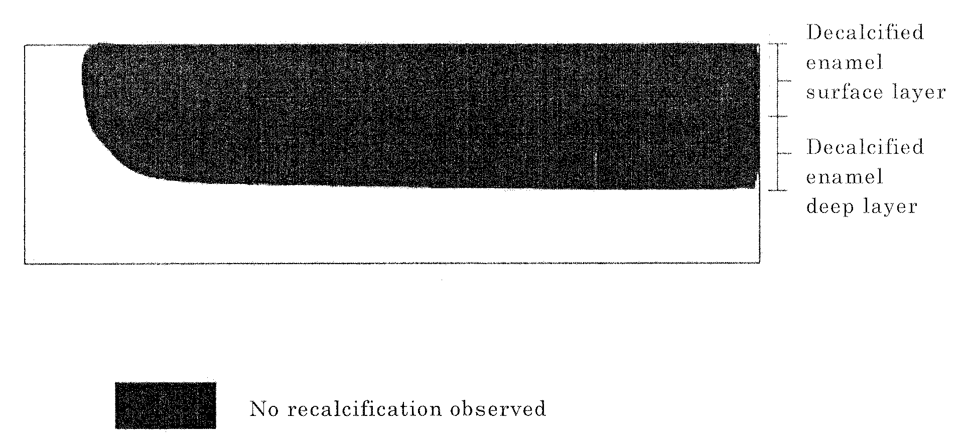 Dental enamel recalcification accelerator and containing the same, oral composition and food or beverage