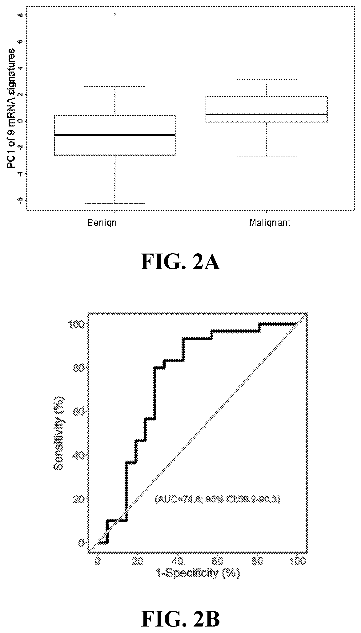 Theranostic tools for management of pancreatic cancer and its precursors