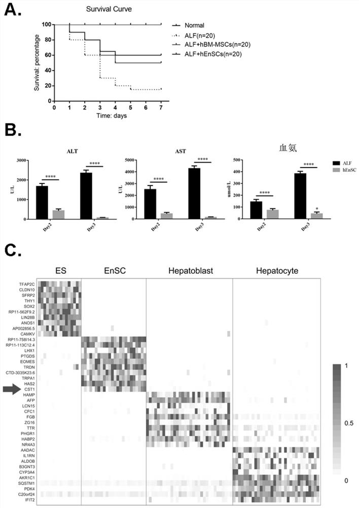 Application of CST1 in prevention and/or treatment of liver immune disorder diseases