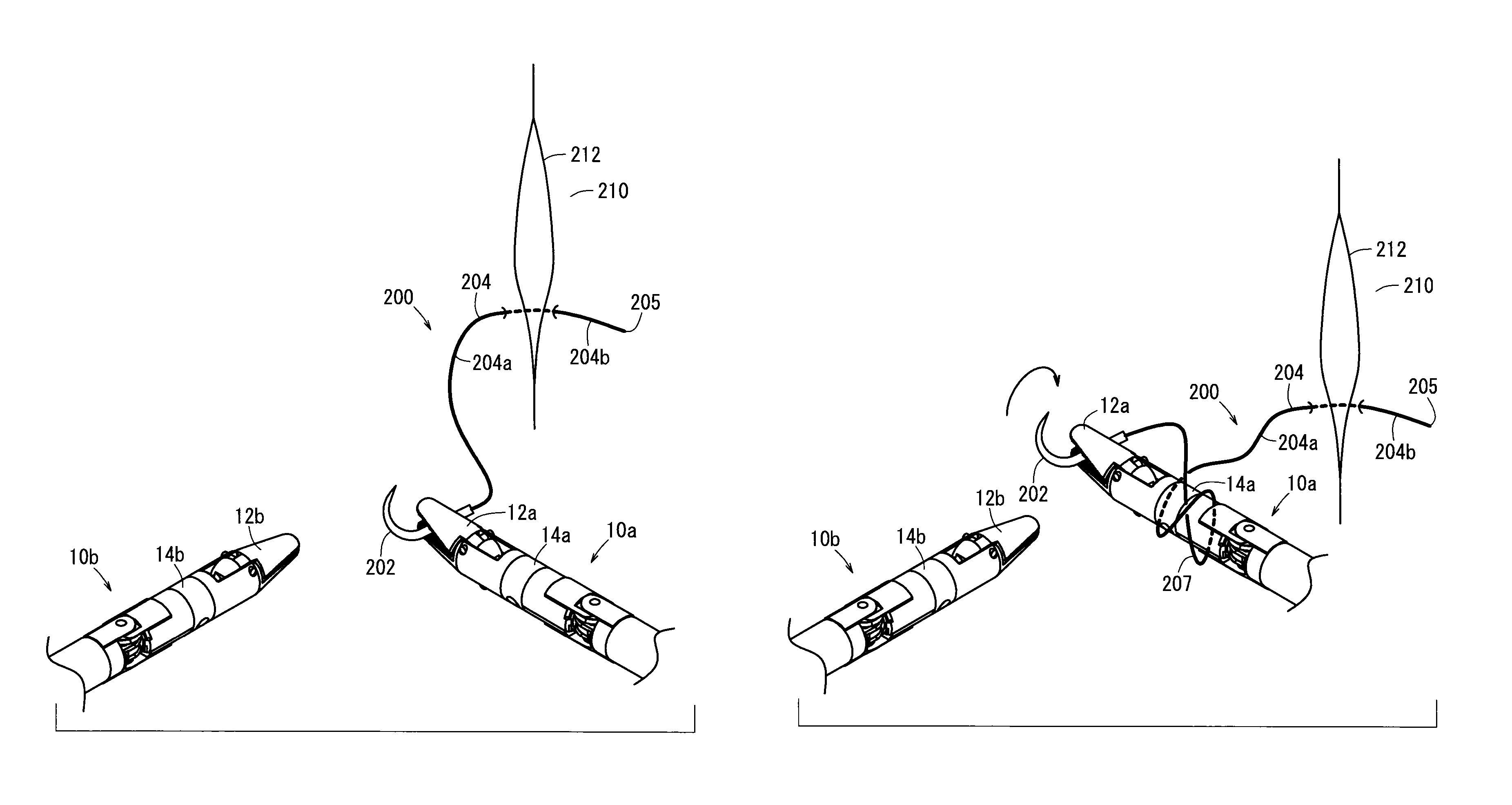 Suturing and ligating method