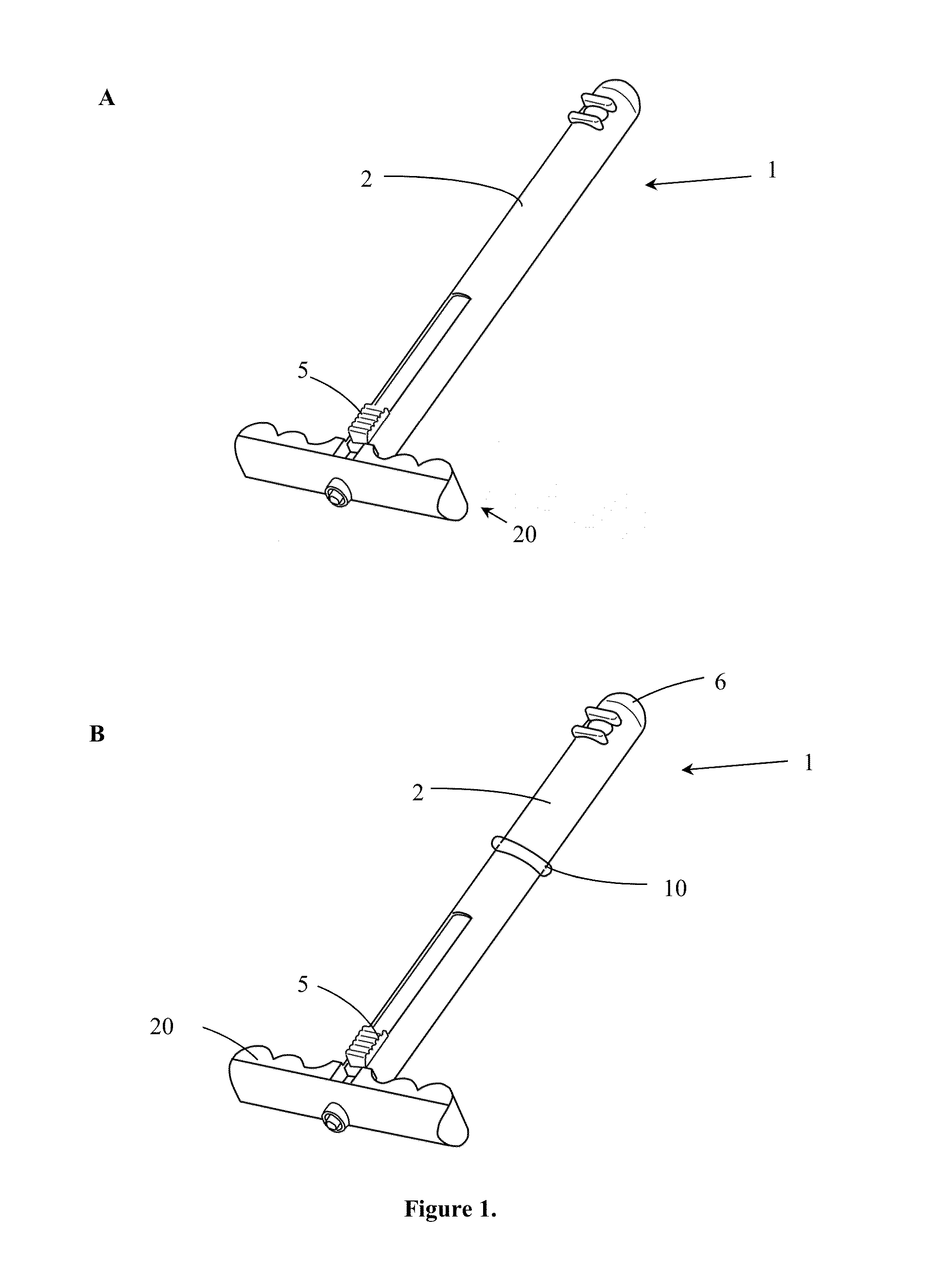 Transvaginal specimen extraction device