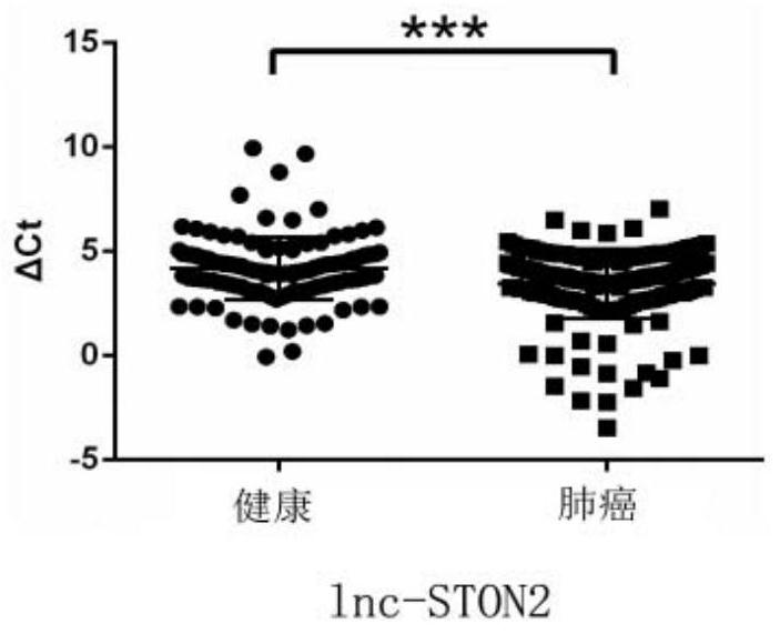 A marker for early diagnosis and early warning of metastasis of lung cancer and kit for its preparation