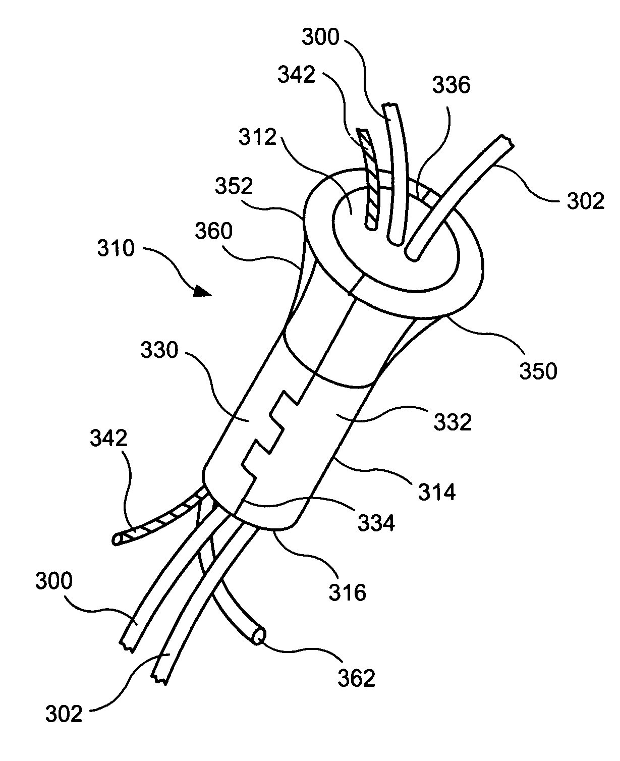 Urethral sealing method and device