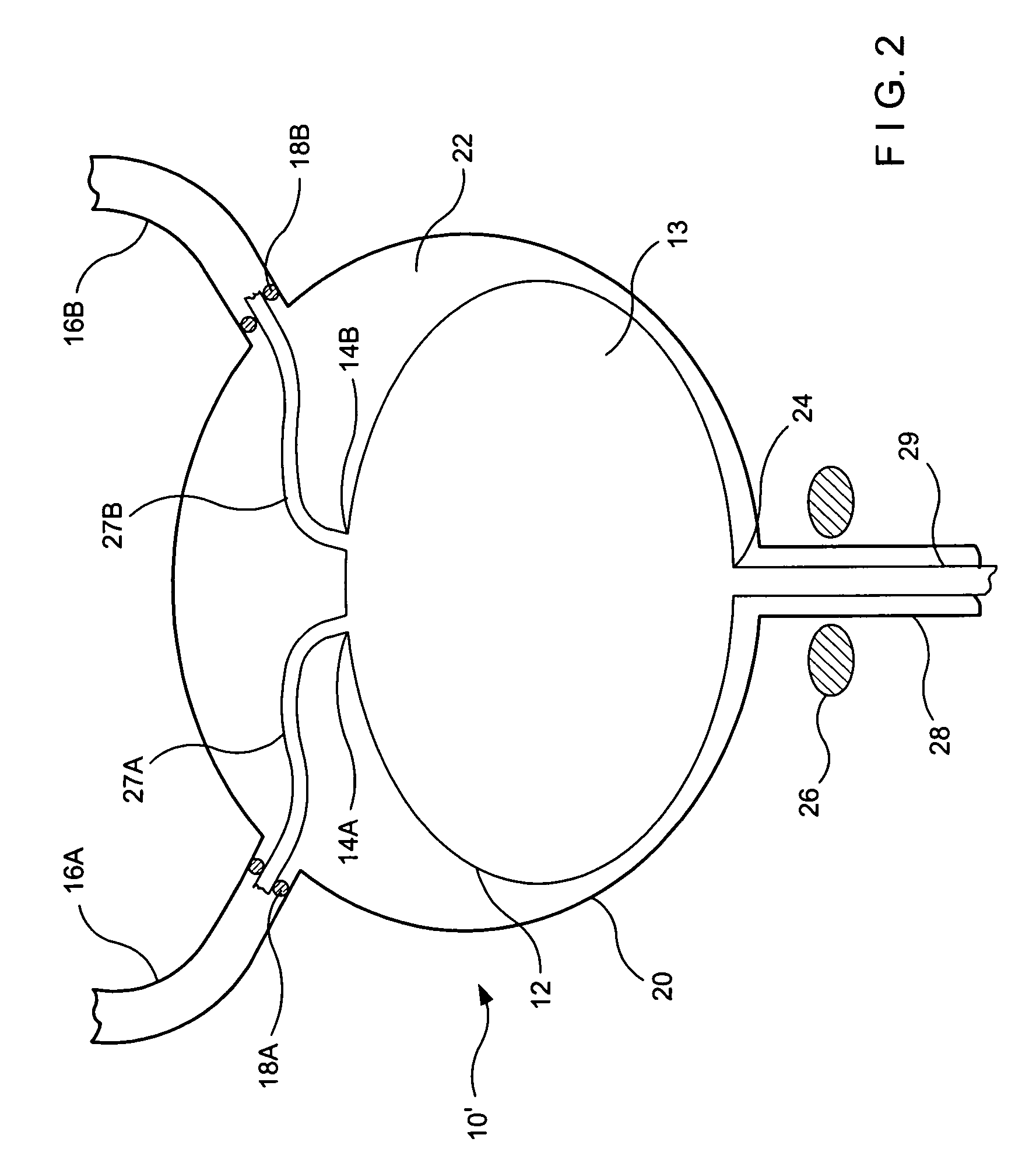 Urethral sealing method and device