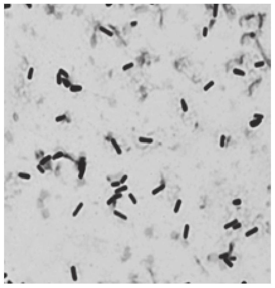 Salt-tolerant strain BY2G20 and application thereof