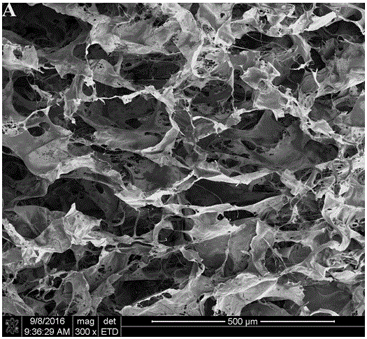 KGN-carried collagen/chitosan/sodium hyaluronate composite scaffold