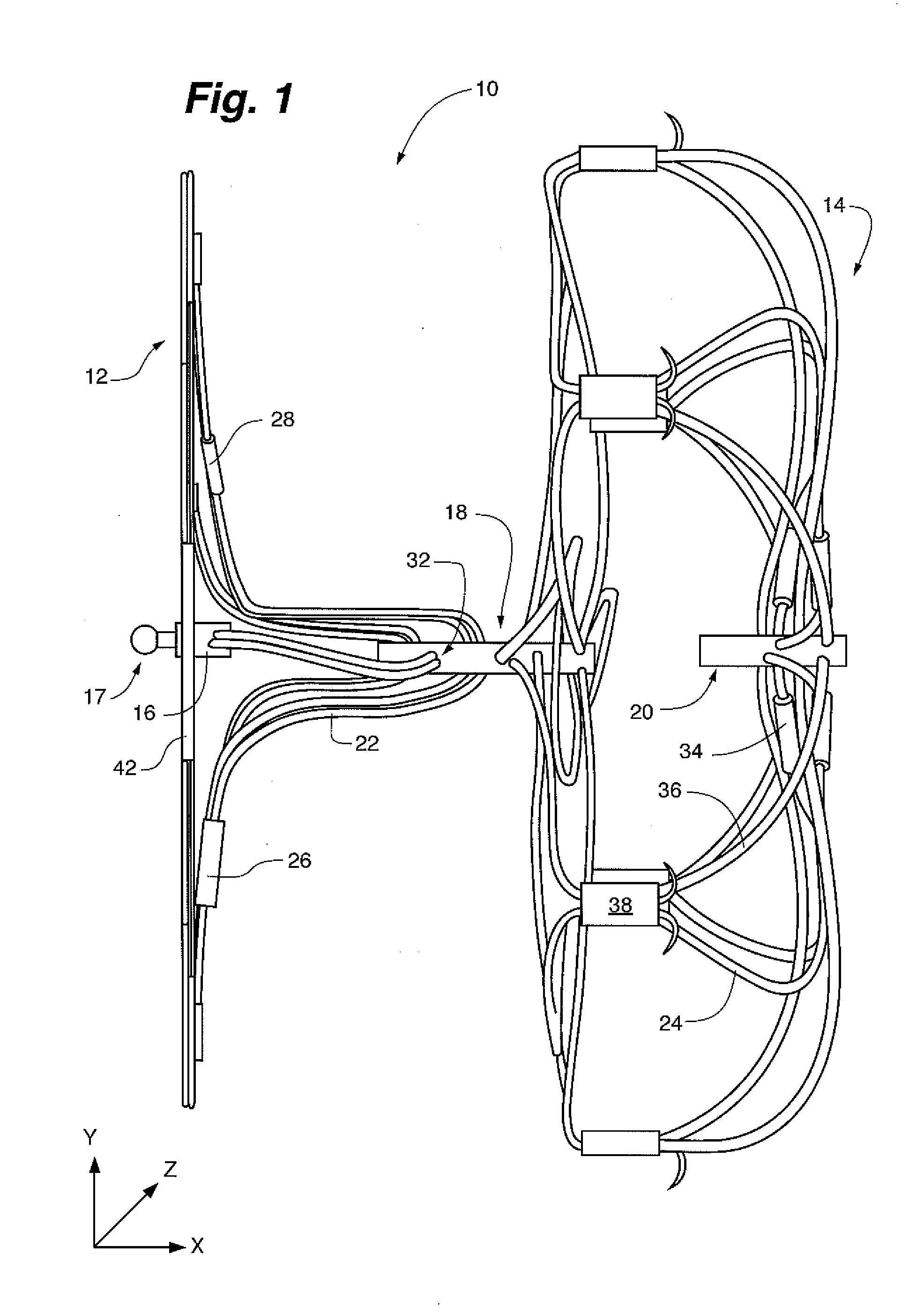 Redeployable left atrial appendage occlusion device