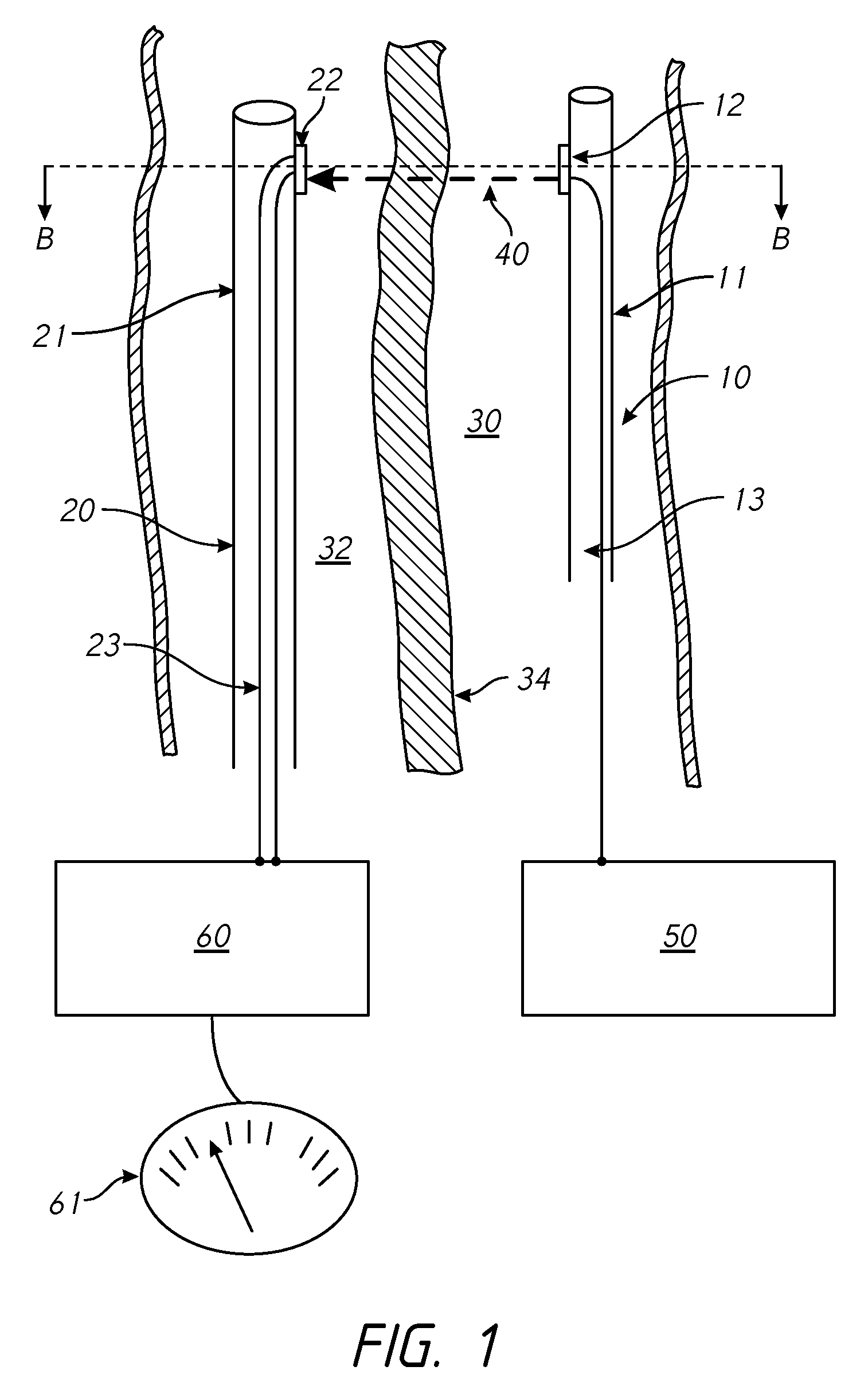 Methods and systems for providing or maintaining fluid flow through body passages