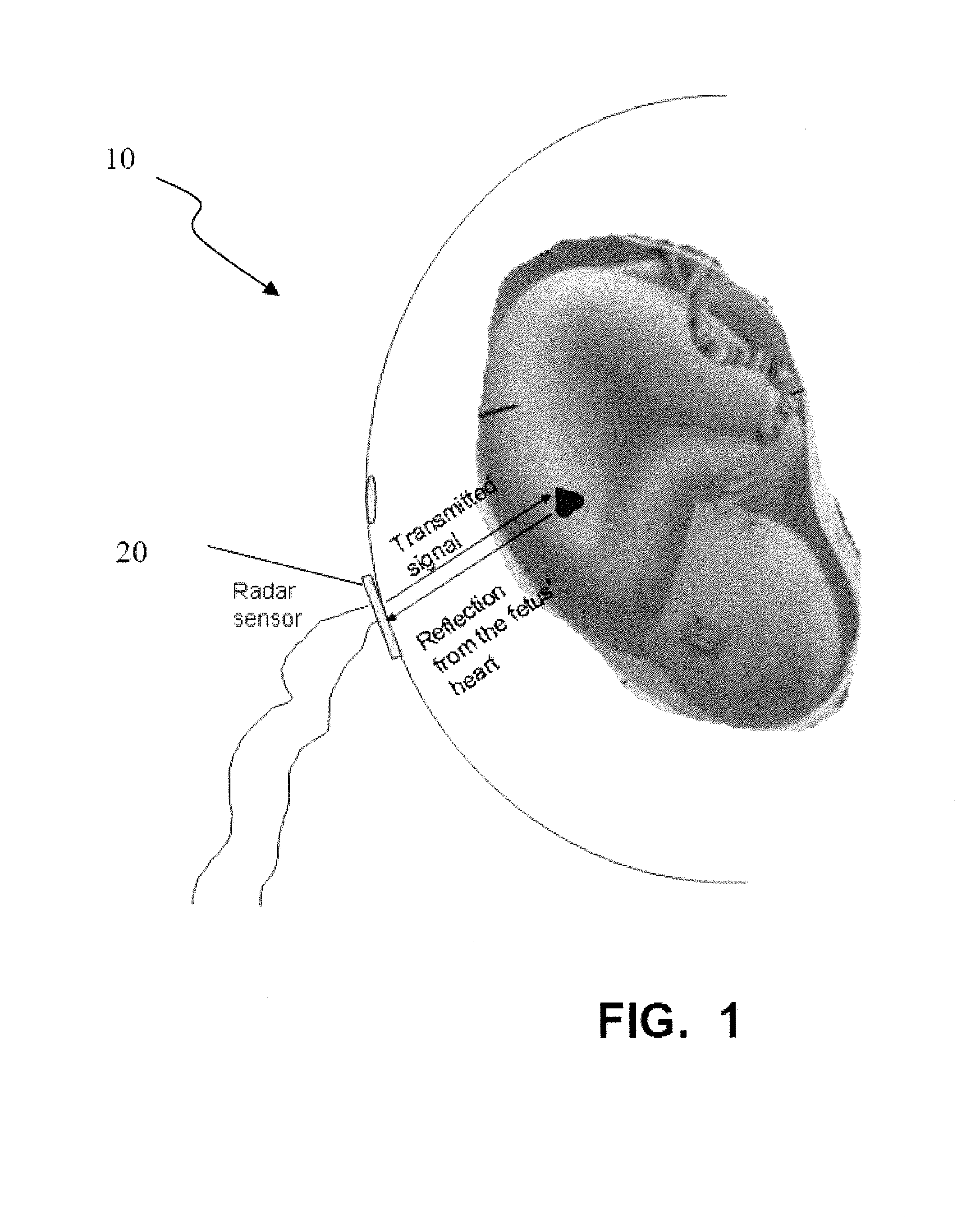 Fetal monitoring device and methods