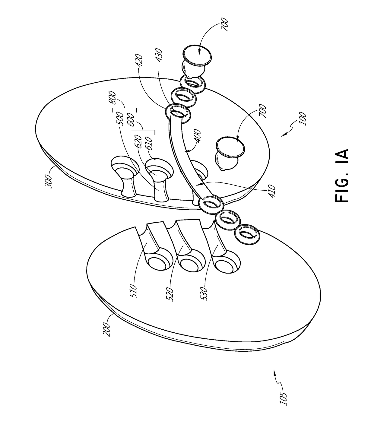 Gluteal implants and implant systems