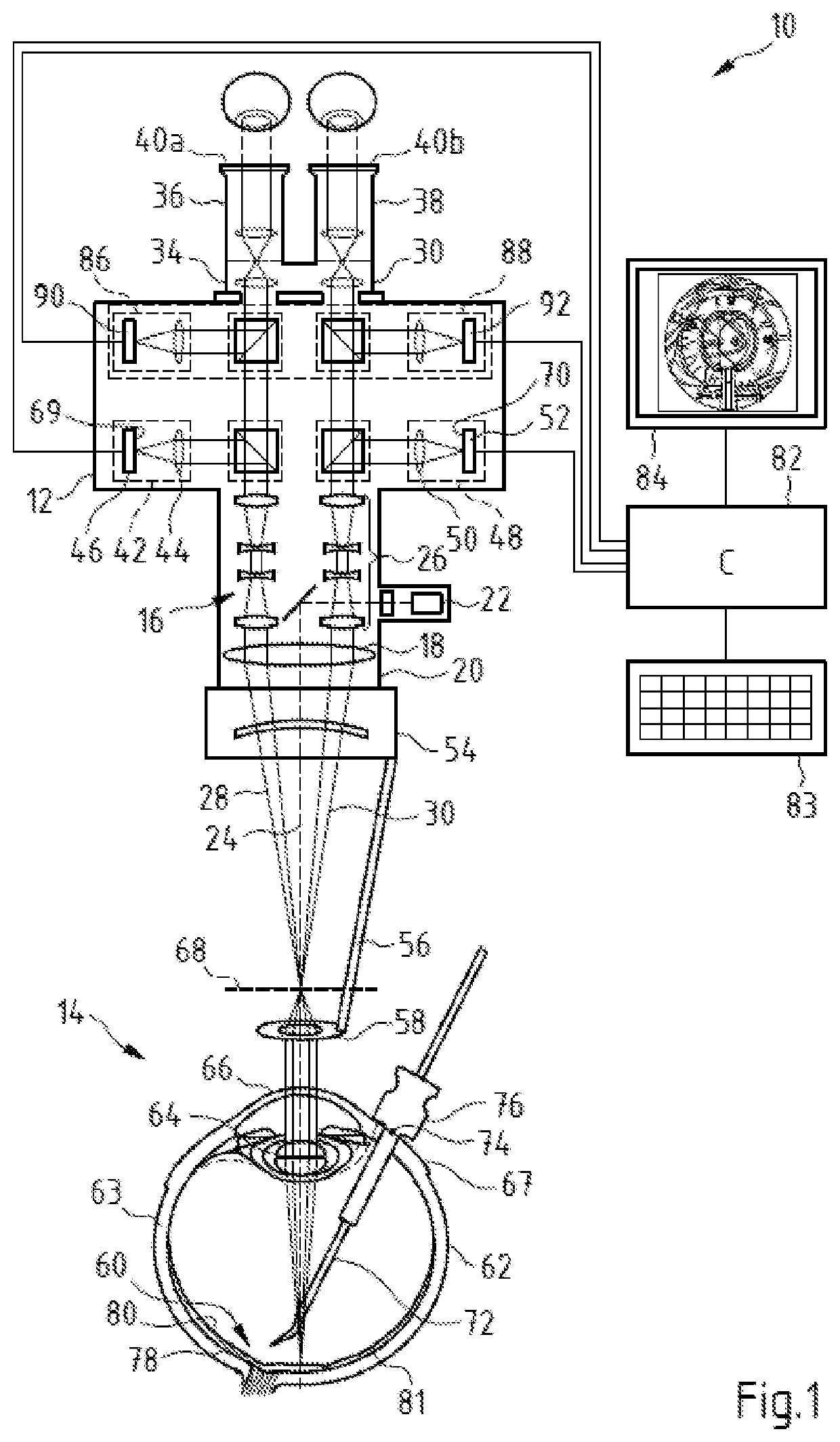 Eye surgery surgical system and computer implemented method for providing the position of at least one trocar point