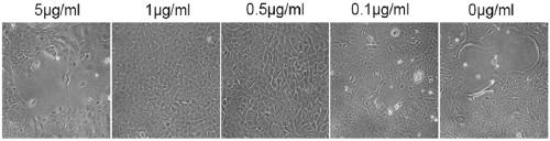 Limbal stem cell (LSC) culture medium and culture method