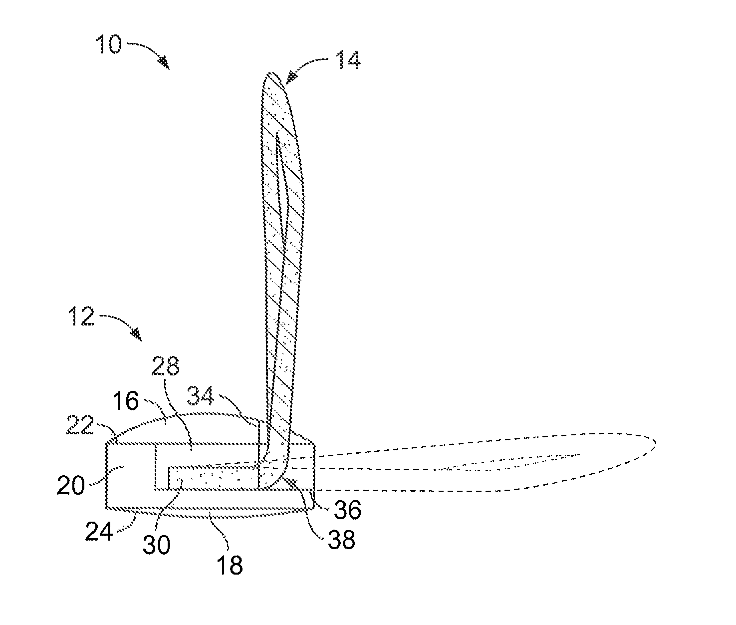 Garment fastening systems