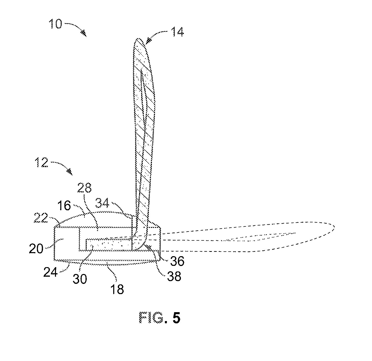 Garment fastening systems