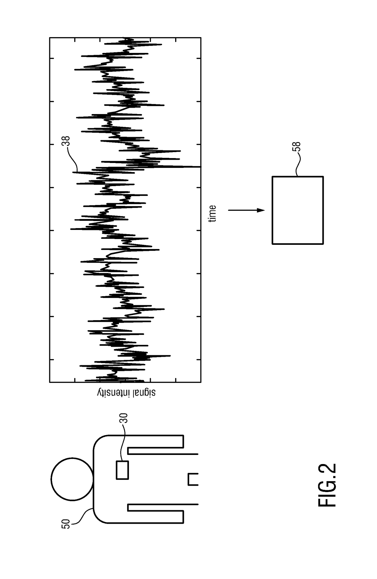 Wearable pain monitor using accelerometry