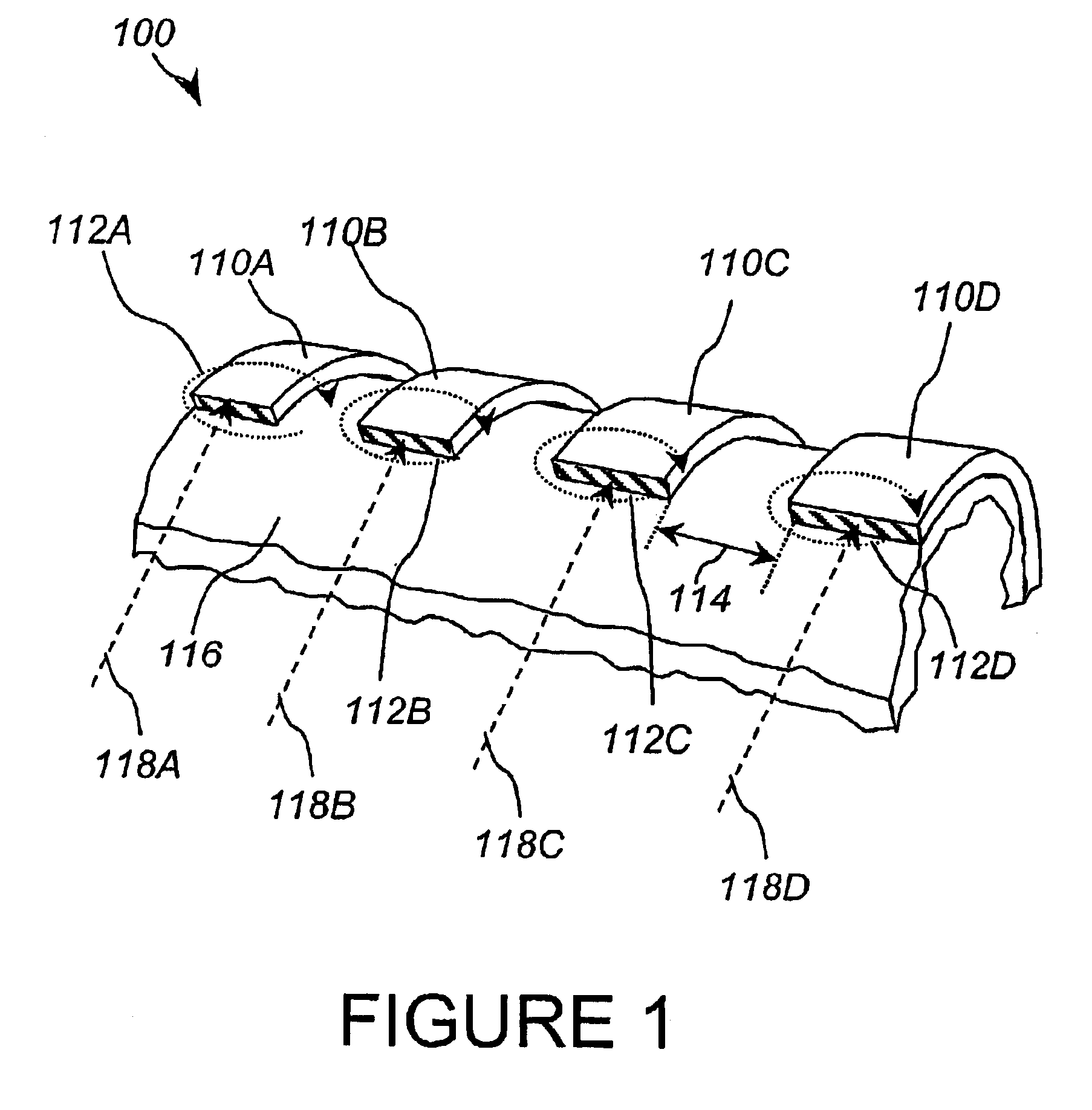 Low alternating current (AC) loss superconducting coils