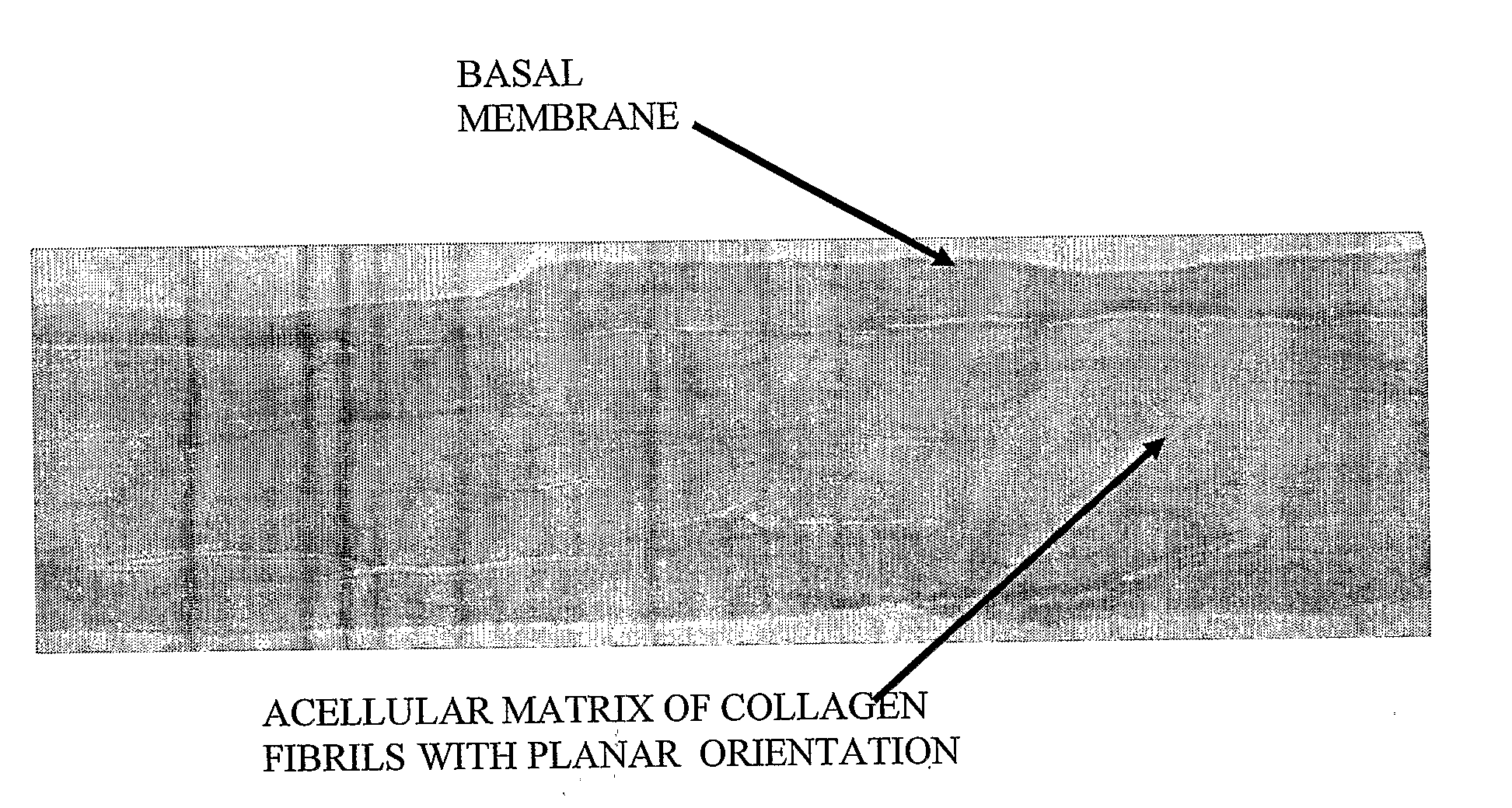 Sterile Autologous, Allogenic or Xenogenic Implant and the Method of its Production