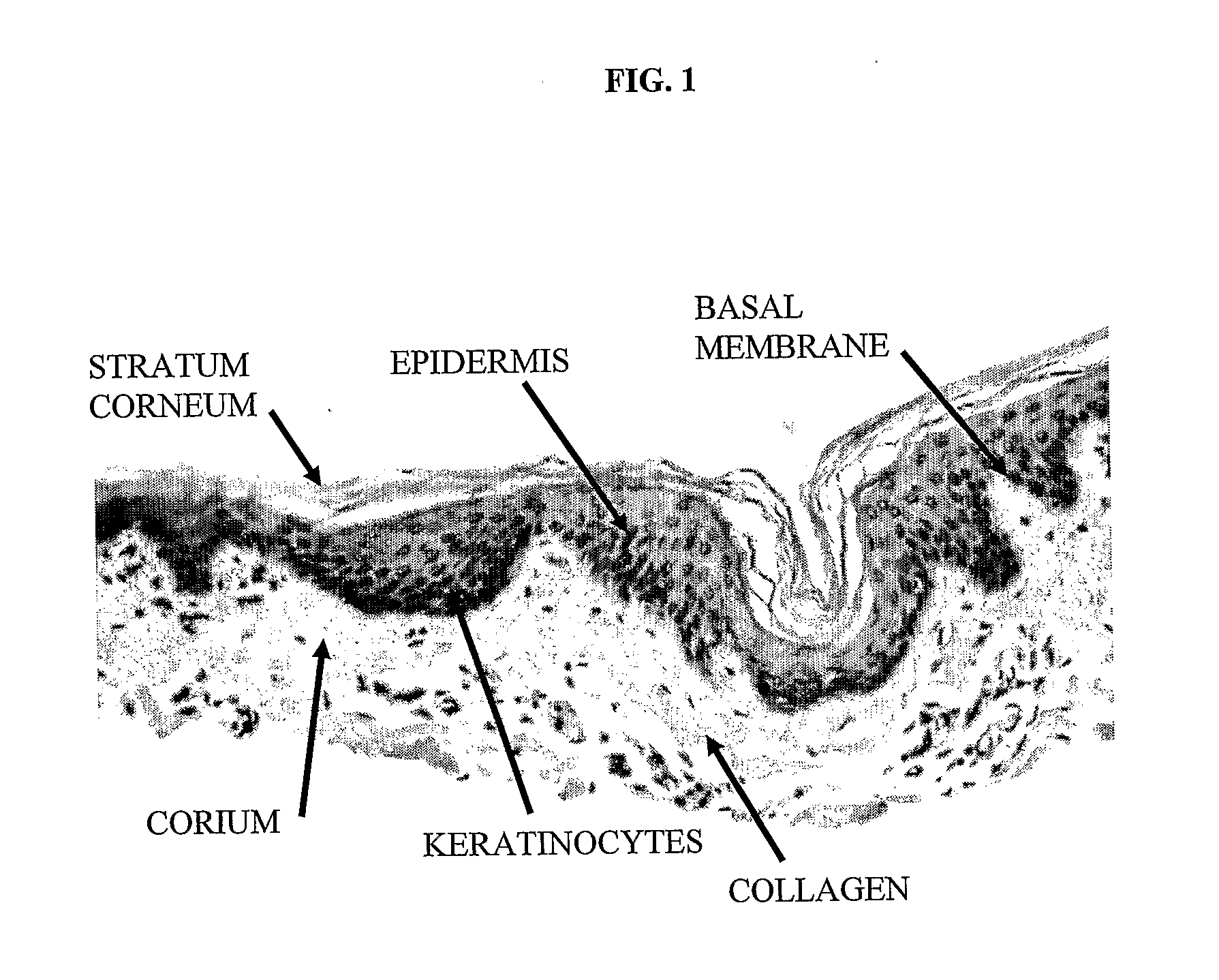 Sterile Autologous, Allogenic or Xenogenic Implant and the Method of its Production