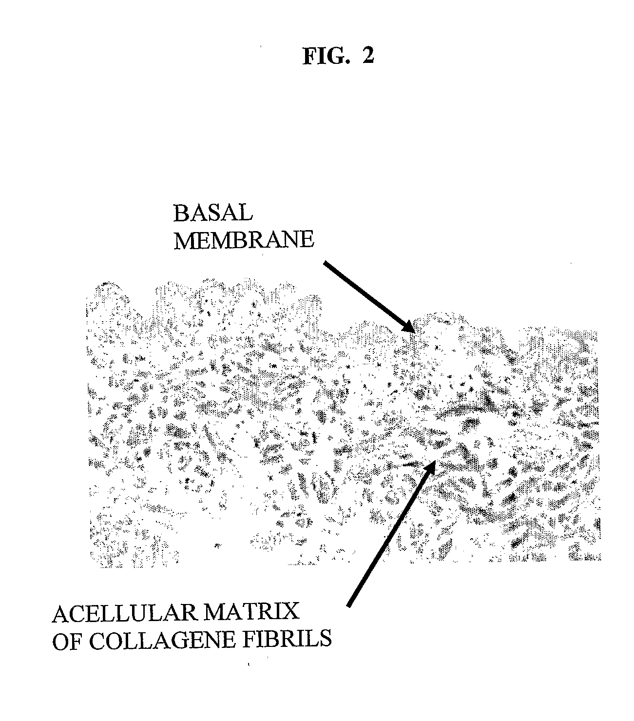 Sterile Autologous, Allogenic or Xenogenic Implant and the Method of its Production