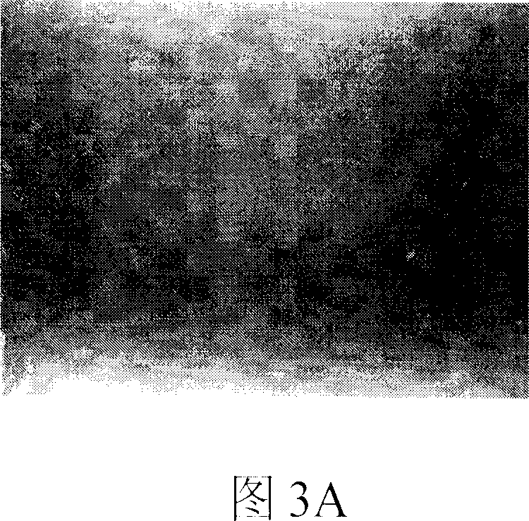 Machine vision based LCD spot flaw detection method and system