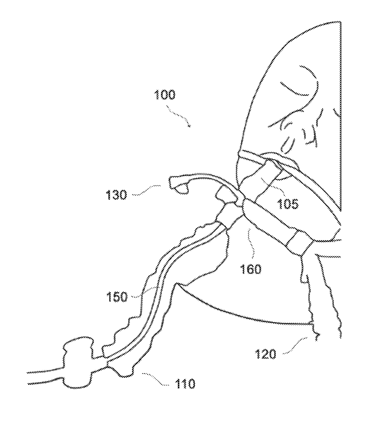 Endotracheal cleaning suction brush