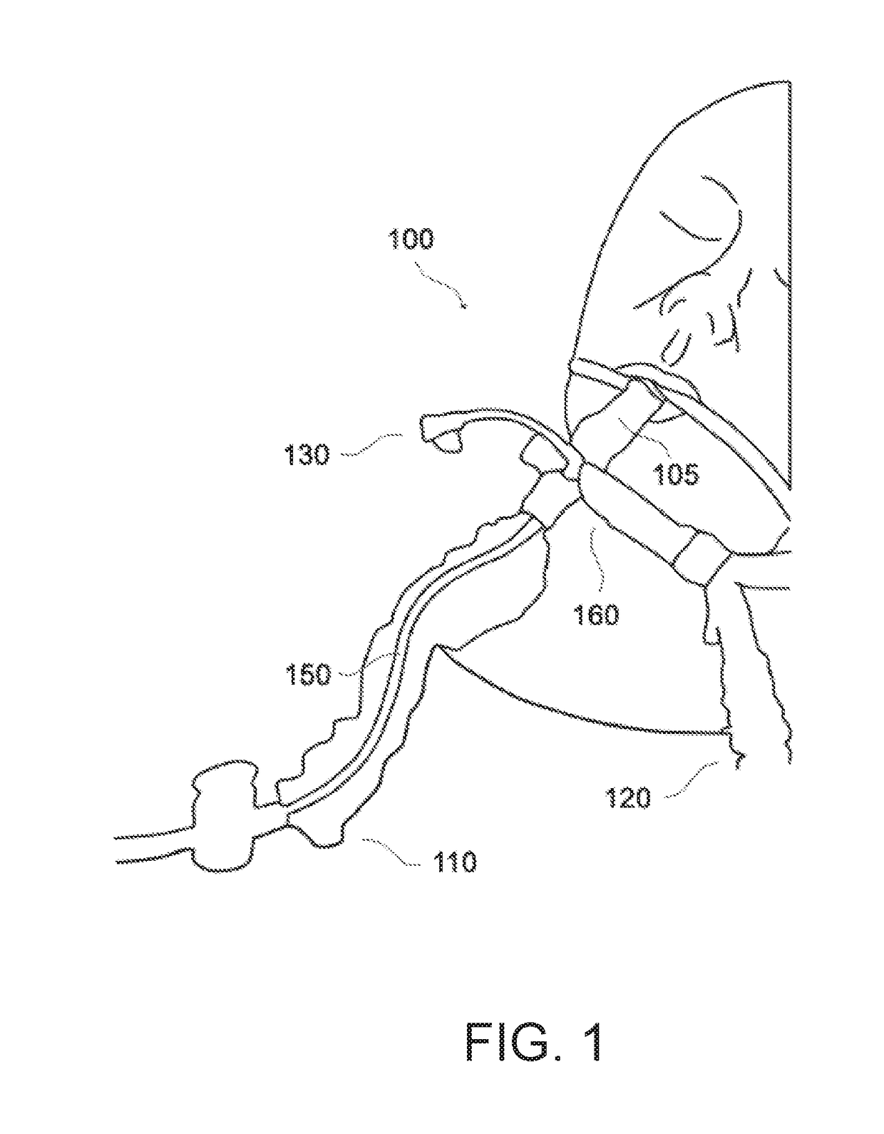 Endotracheal cleaning suction brush