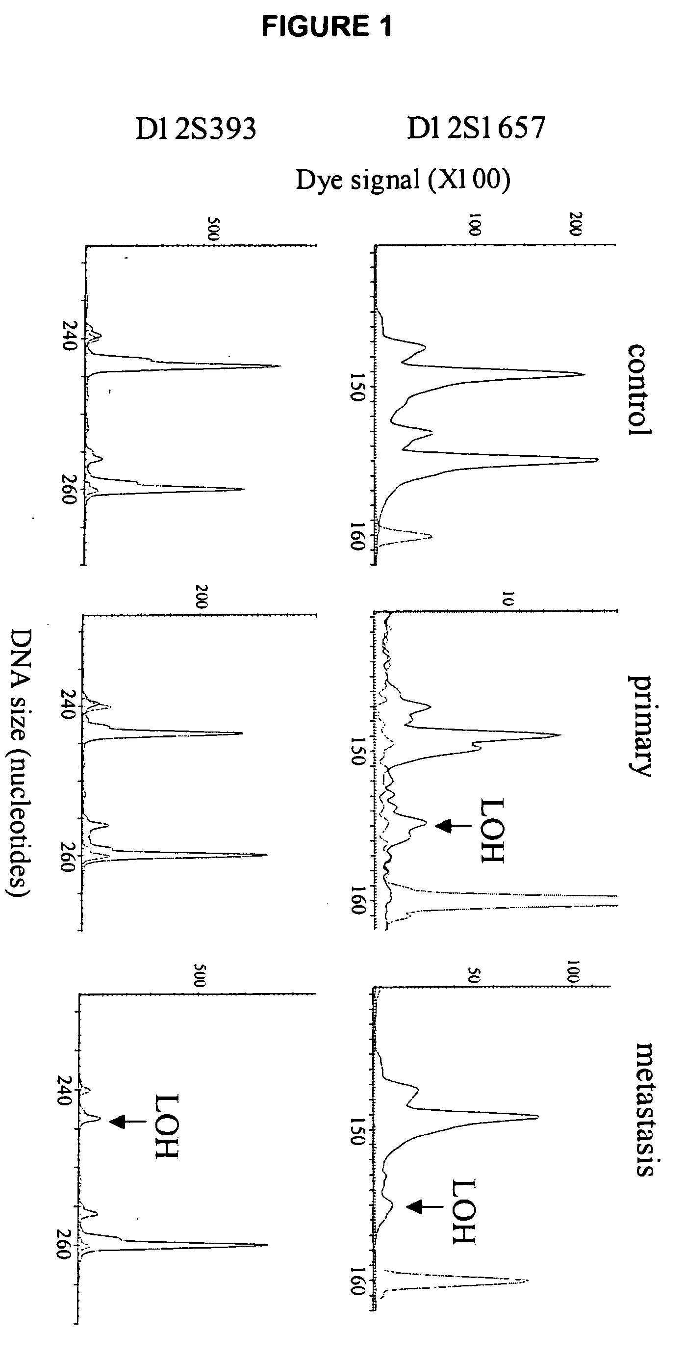 Loss of heterozygosity of the DNA markers in the 12q22-23 region