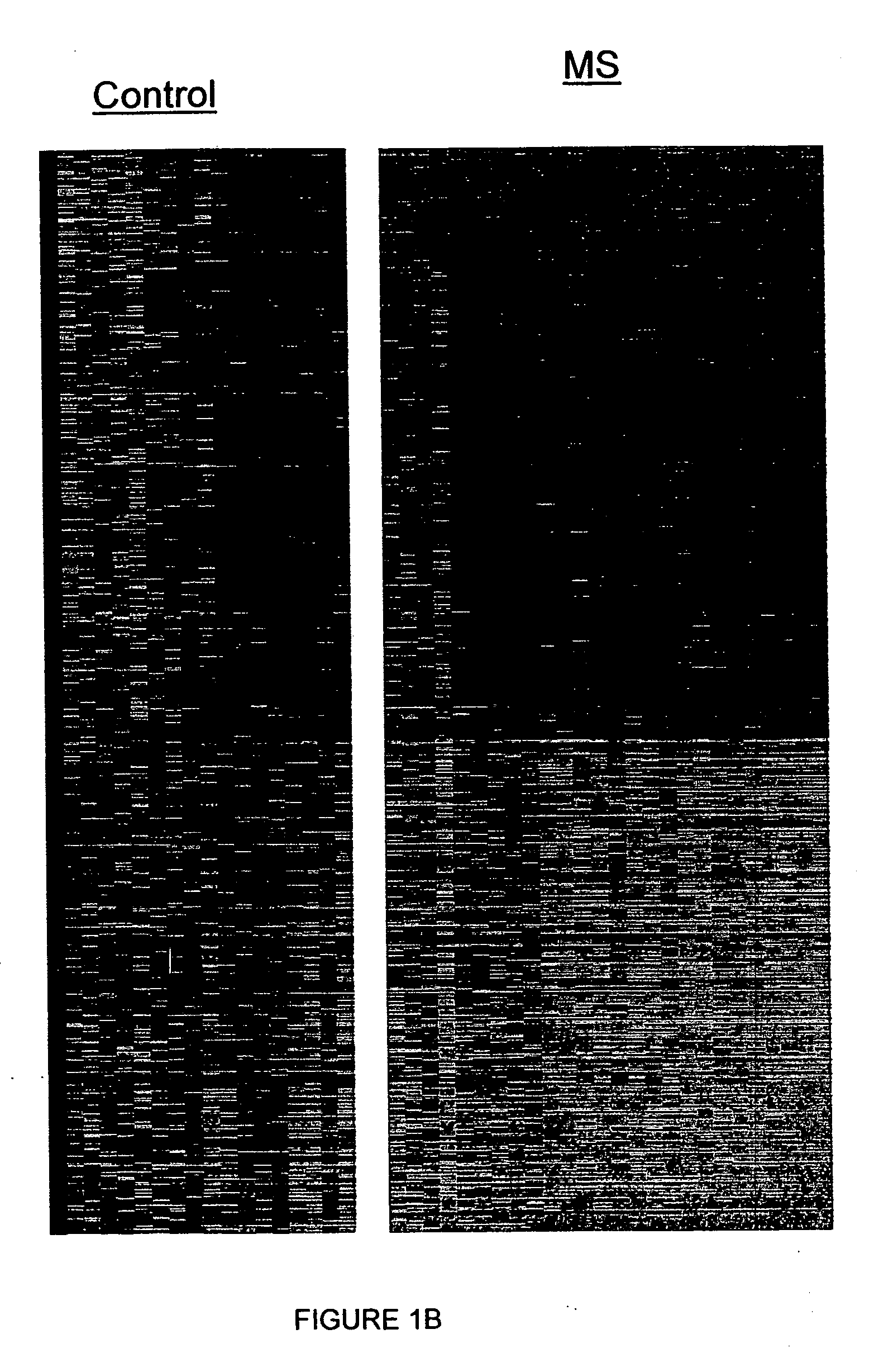 Peripheral blood cell markers useful for diagnosing multiple sclerosis and methods and kits utilizing same