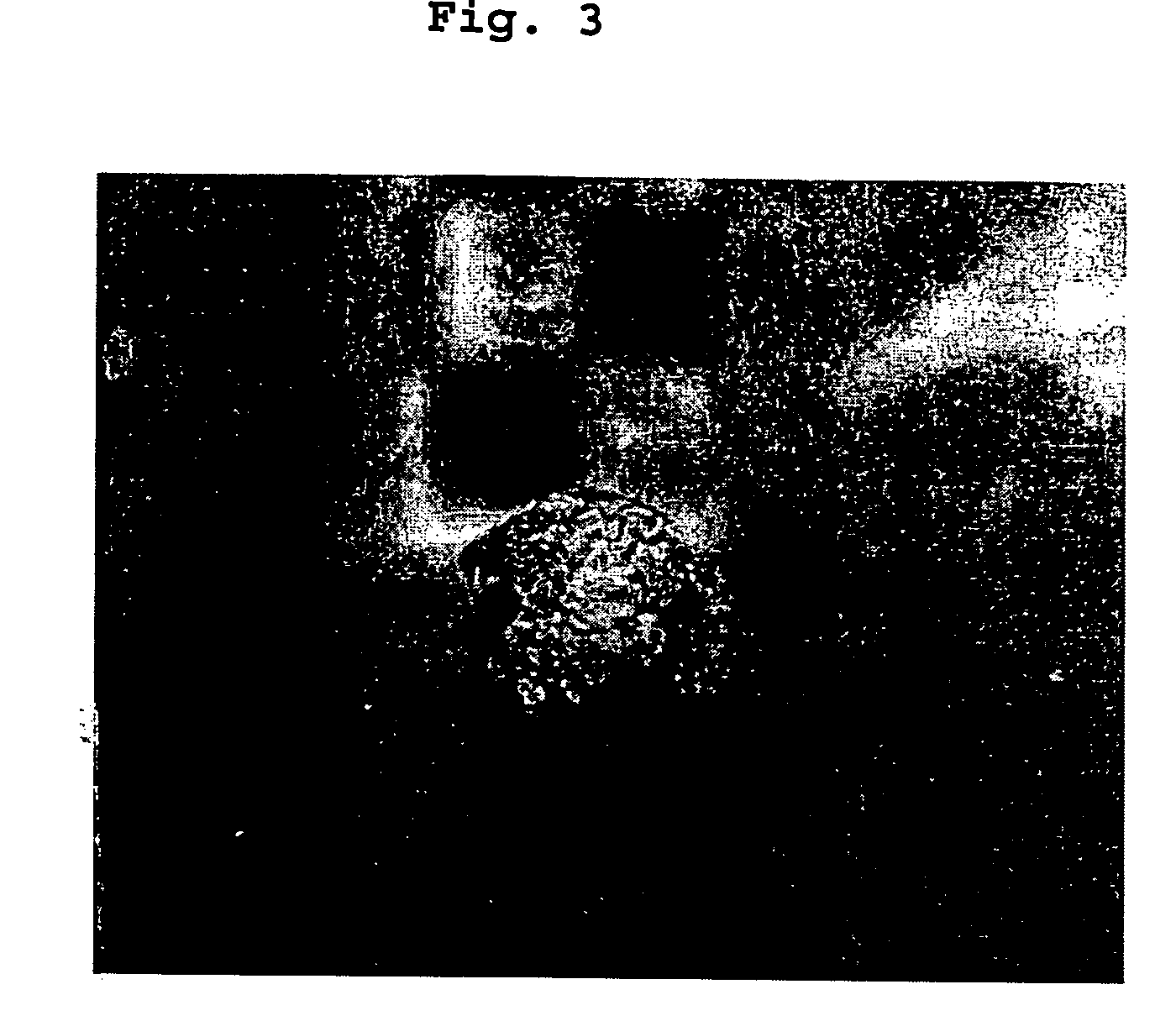 Cured porous calcium phosphate material and uses thereof