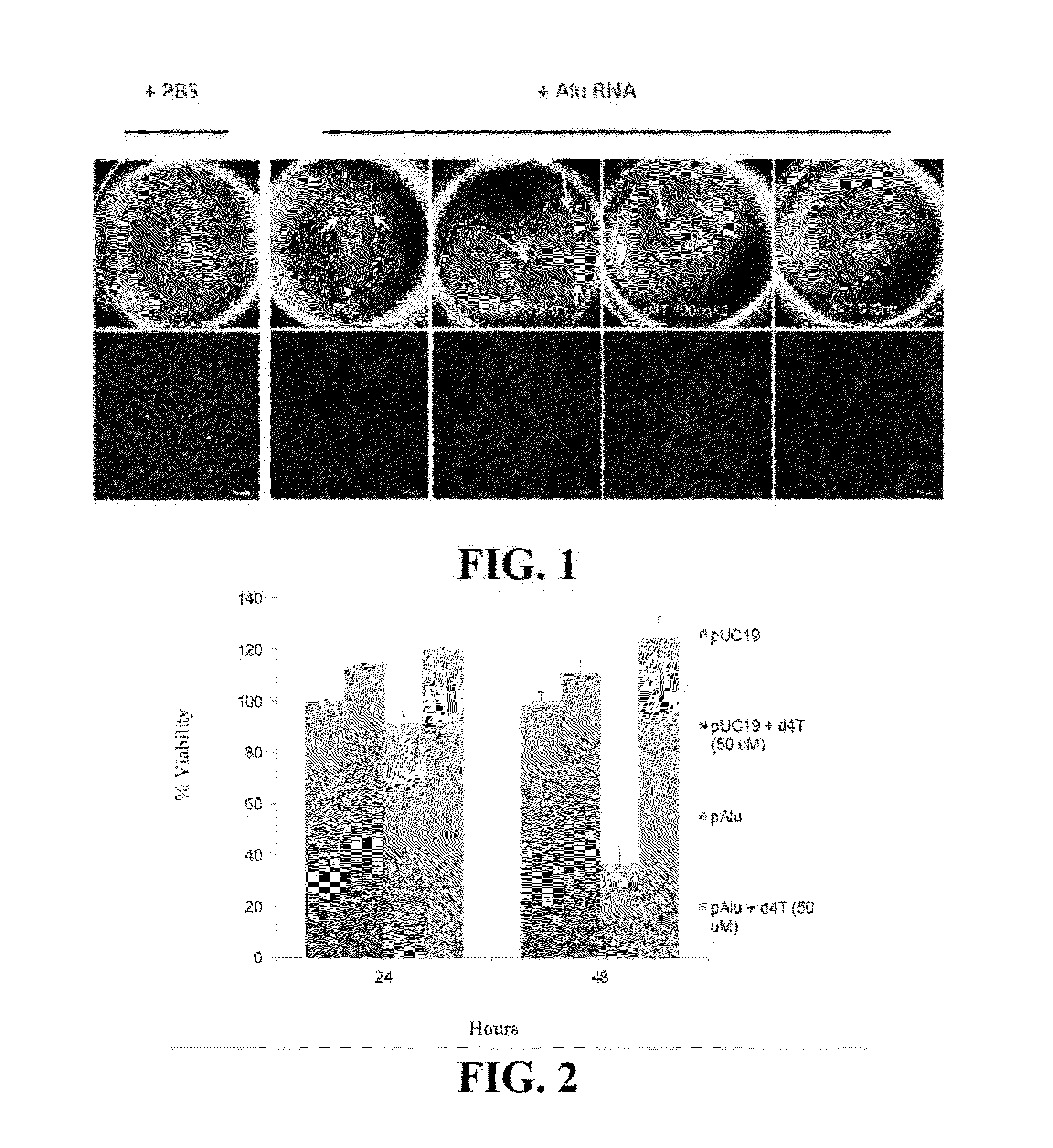 Compositions and methods for treating retinal degradation