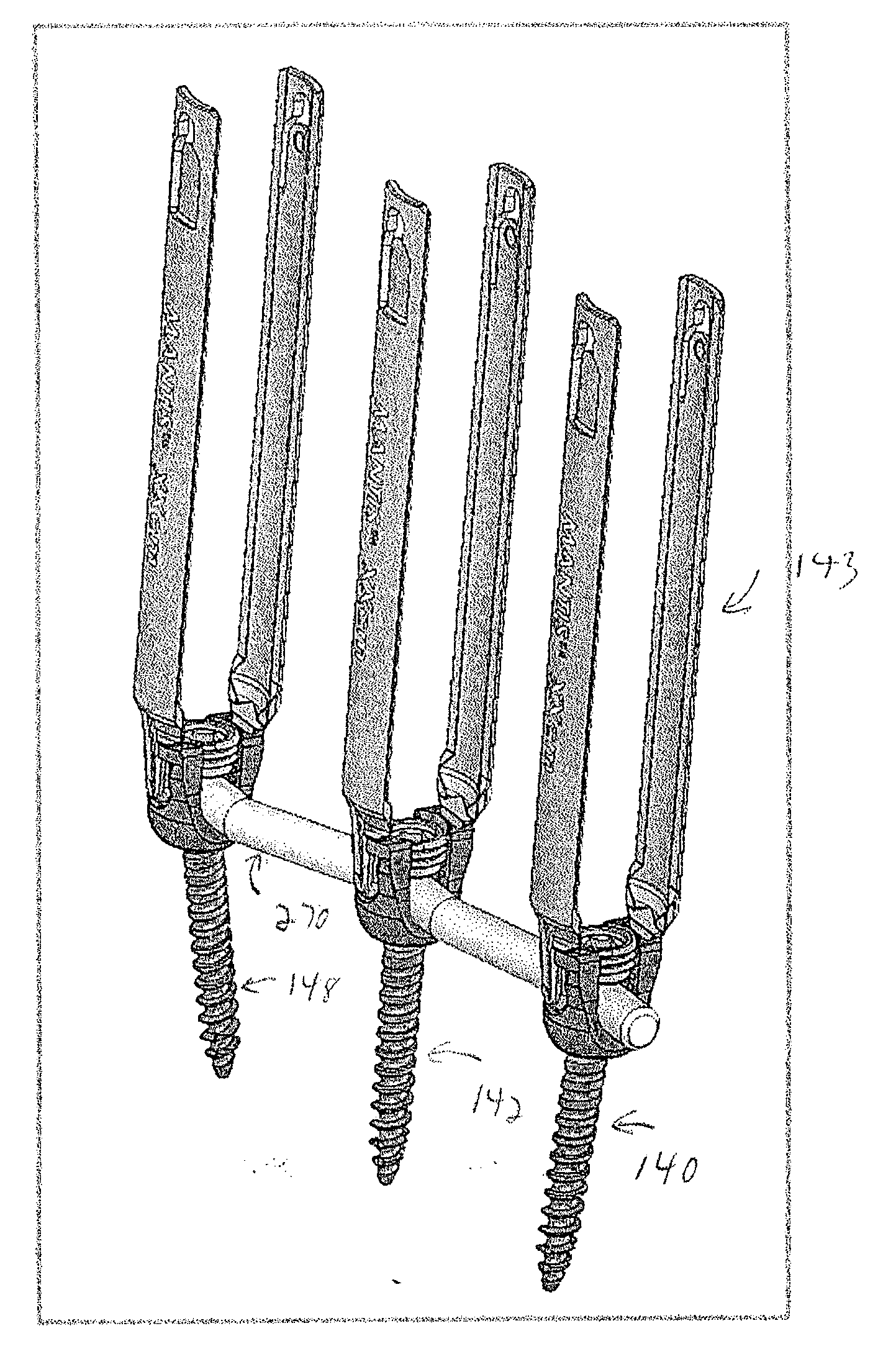 Rod contouring apparatus and method for percutaneous pedicle screw extension