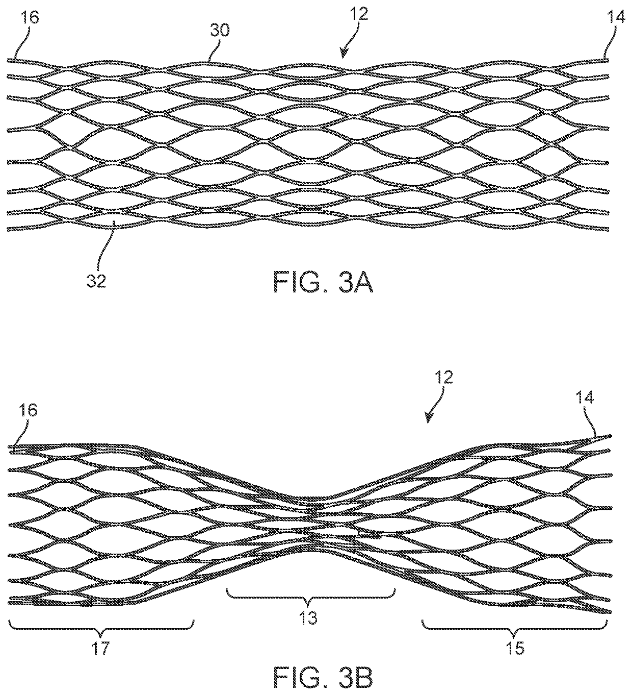 Vascular valve prosthesis