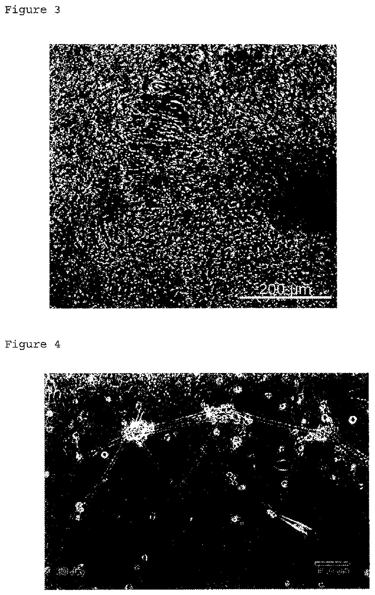 Method for manufacturing peripheral nerve cells