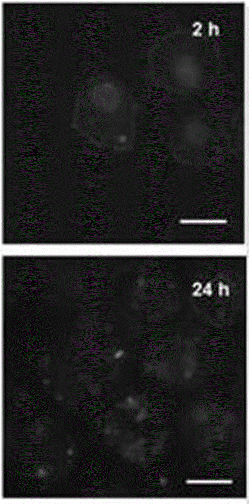 Preparation method of metal polyphenol vesicle material with micrometer/nanometer multilayer composite structure