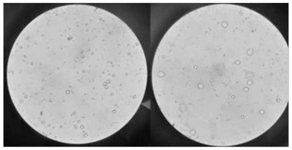 Preparation method of hyaluronic acid filling agent