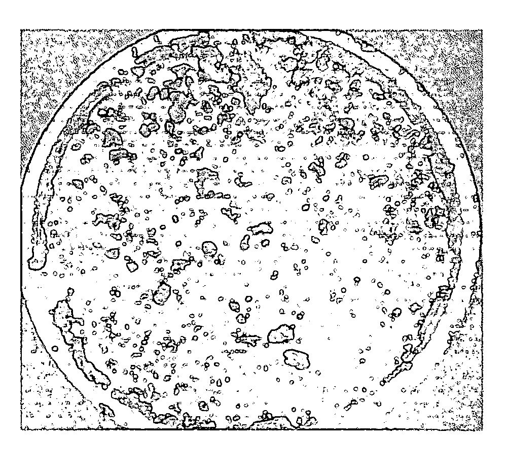 Method of removing an invert emulsion filter cake after the drilling process using a single phase microemulsion