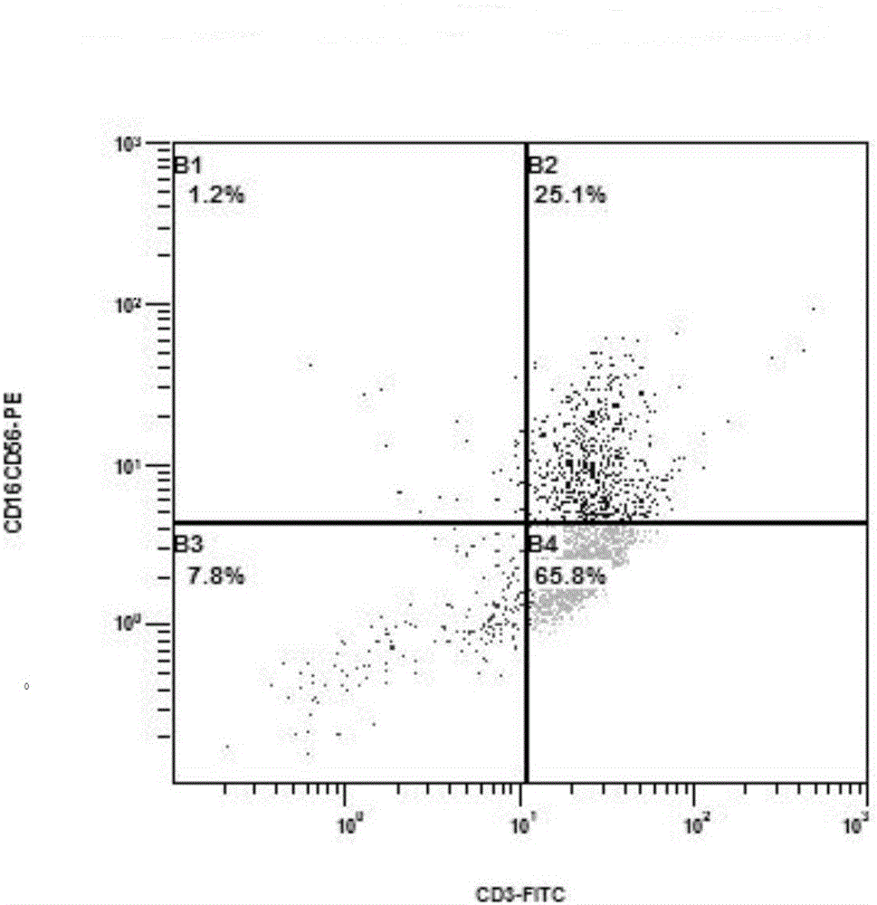 Preparation of mesothelin chimeric antigen receptor modified T cells and application of T cells in pancreatic cancer treatment