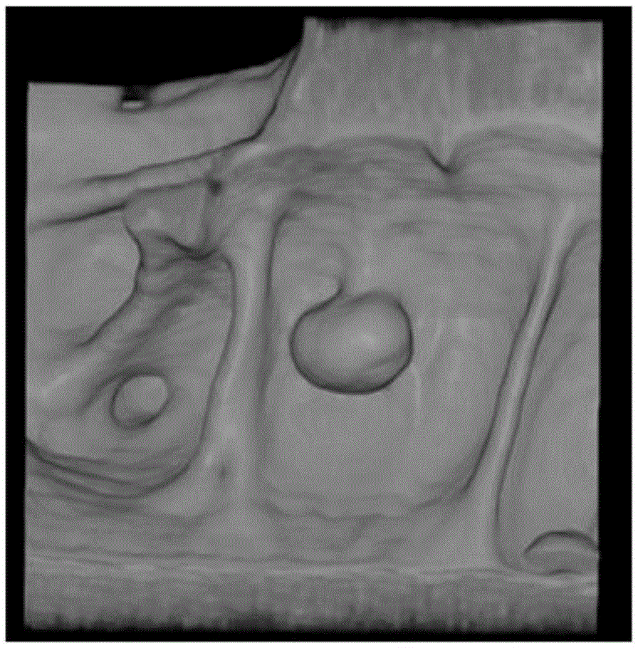 Method and apparatus for segmenting three-dimensional medical image