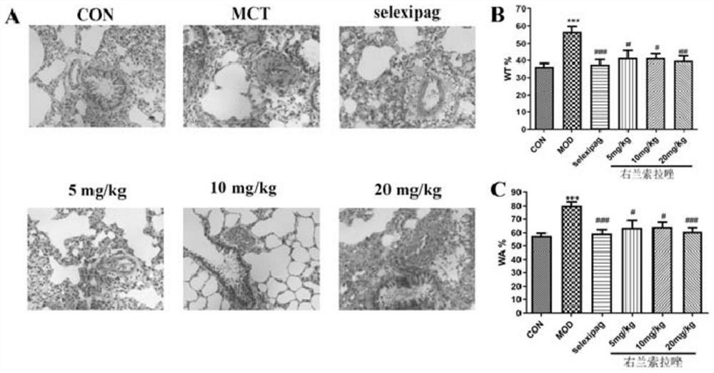 Compound for treating pulmonary arterial hypertension and application thereof