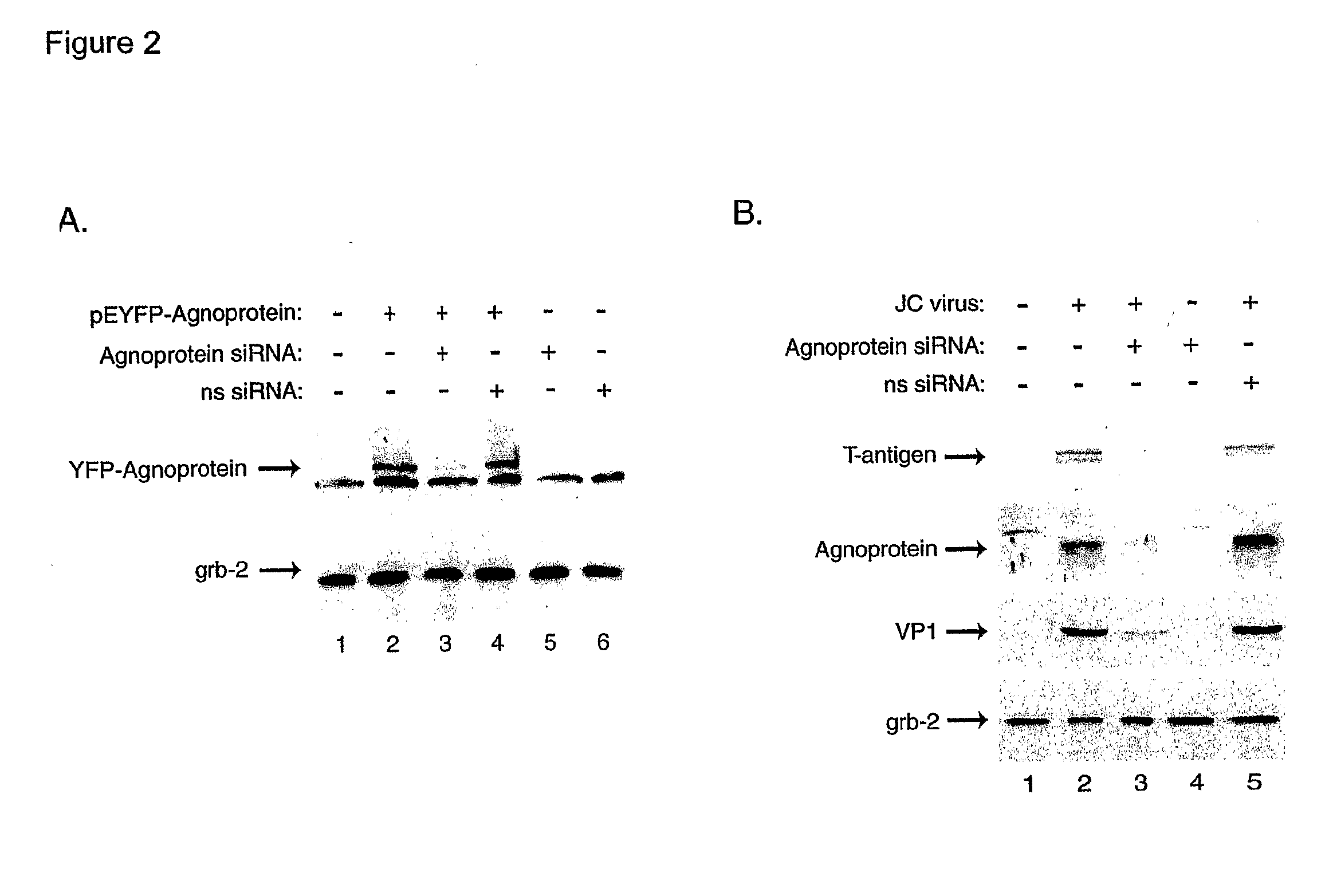 Compositions and Methods for Sirna Inhibition of Primate Polyomavirus Genes