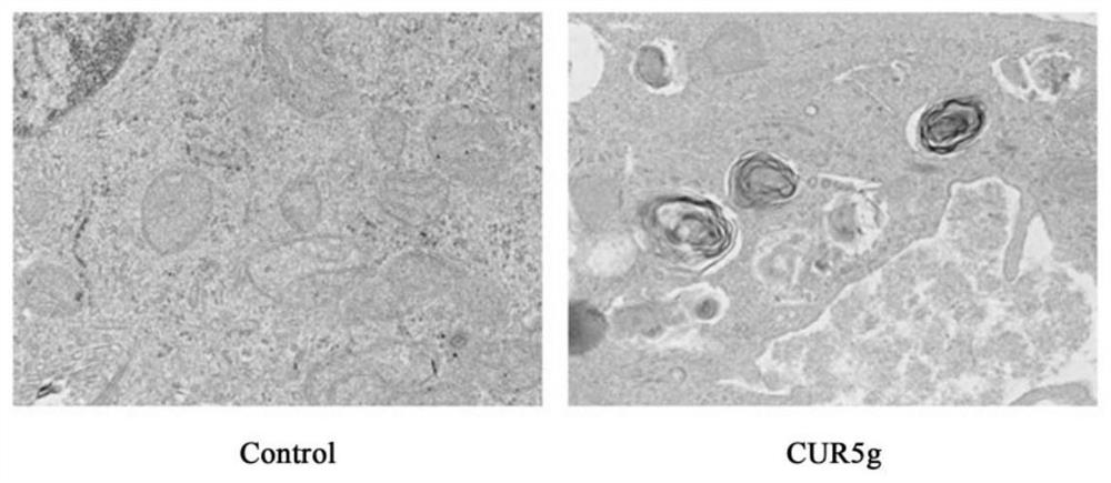 Application of curcumin analogue CUR5g as novel autophagy inhibitor