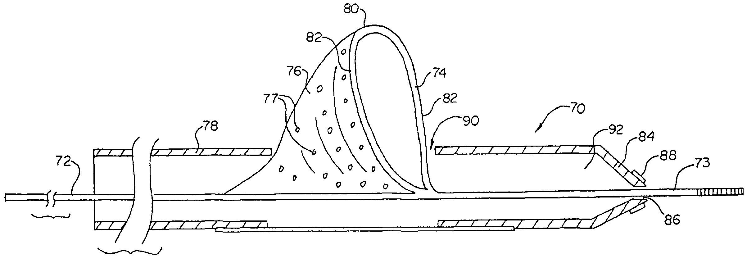 Vascular filter having articulation region and methods of use in the ascending aorta