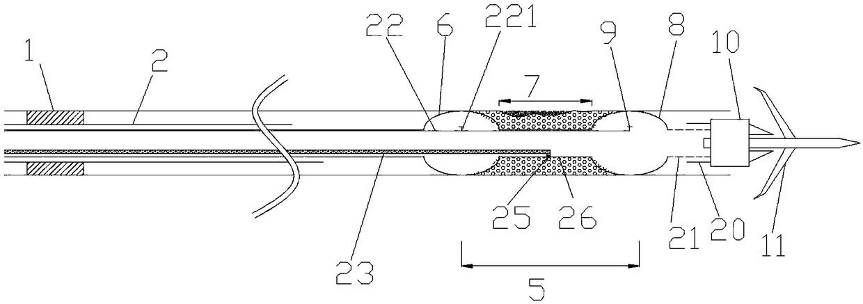 Foam concrete slip-casting system and method for mine hole collapse prevention