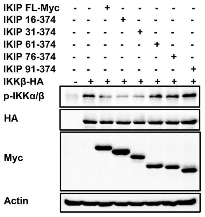 IKK beta-targeted short peptide and application thereof in inflammatory diseases