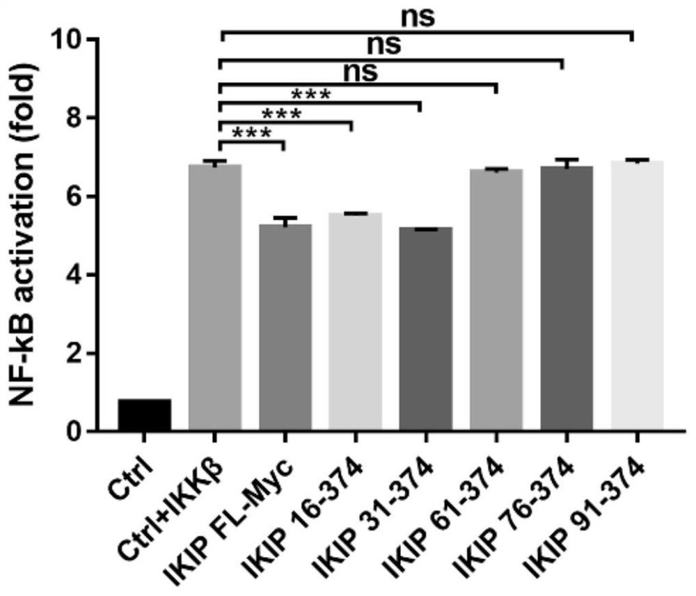 IKK beta-targeted short peptide and application thereof in inflammatory diseases