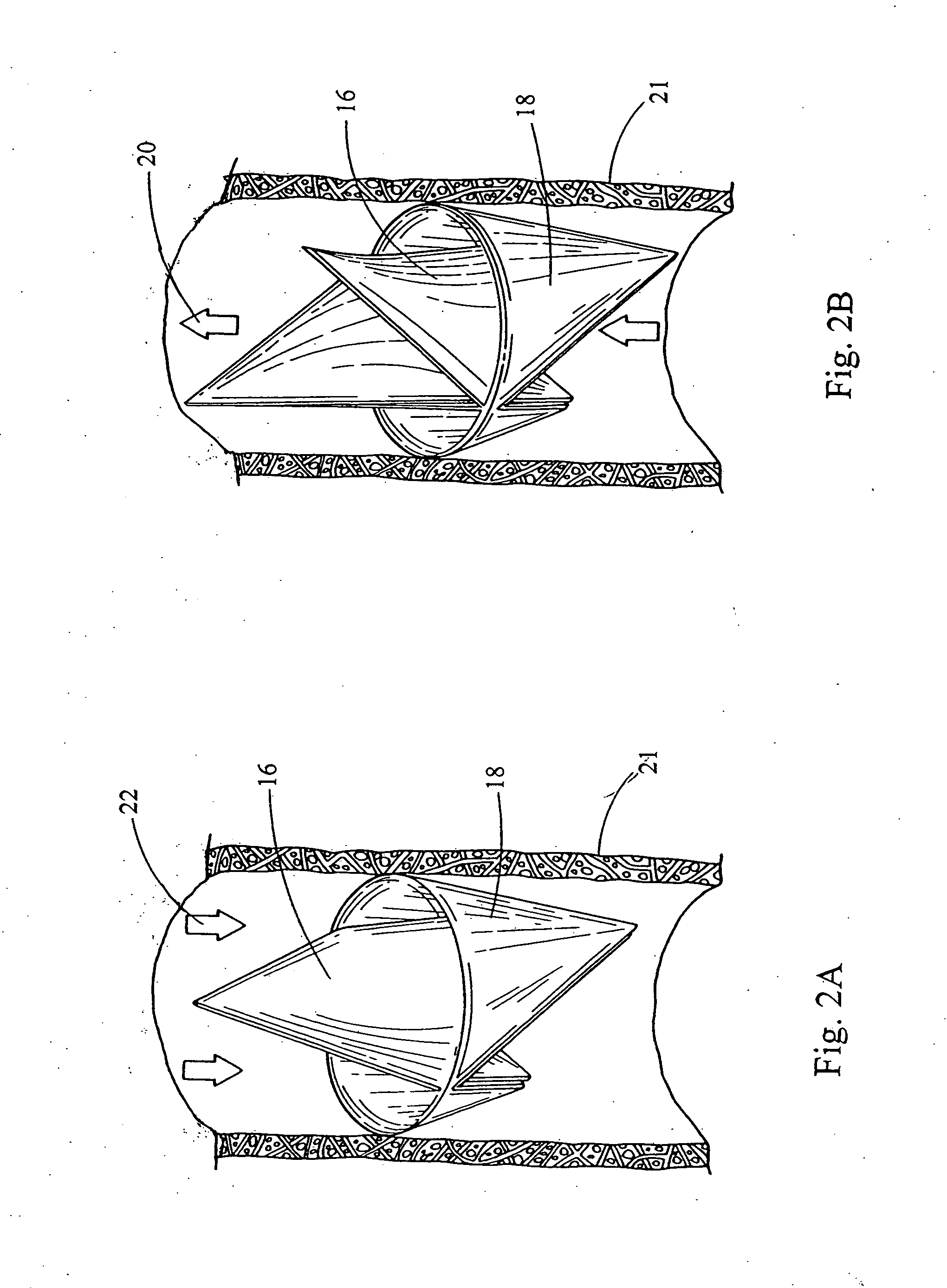 Prosthetic valve