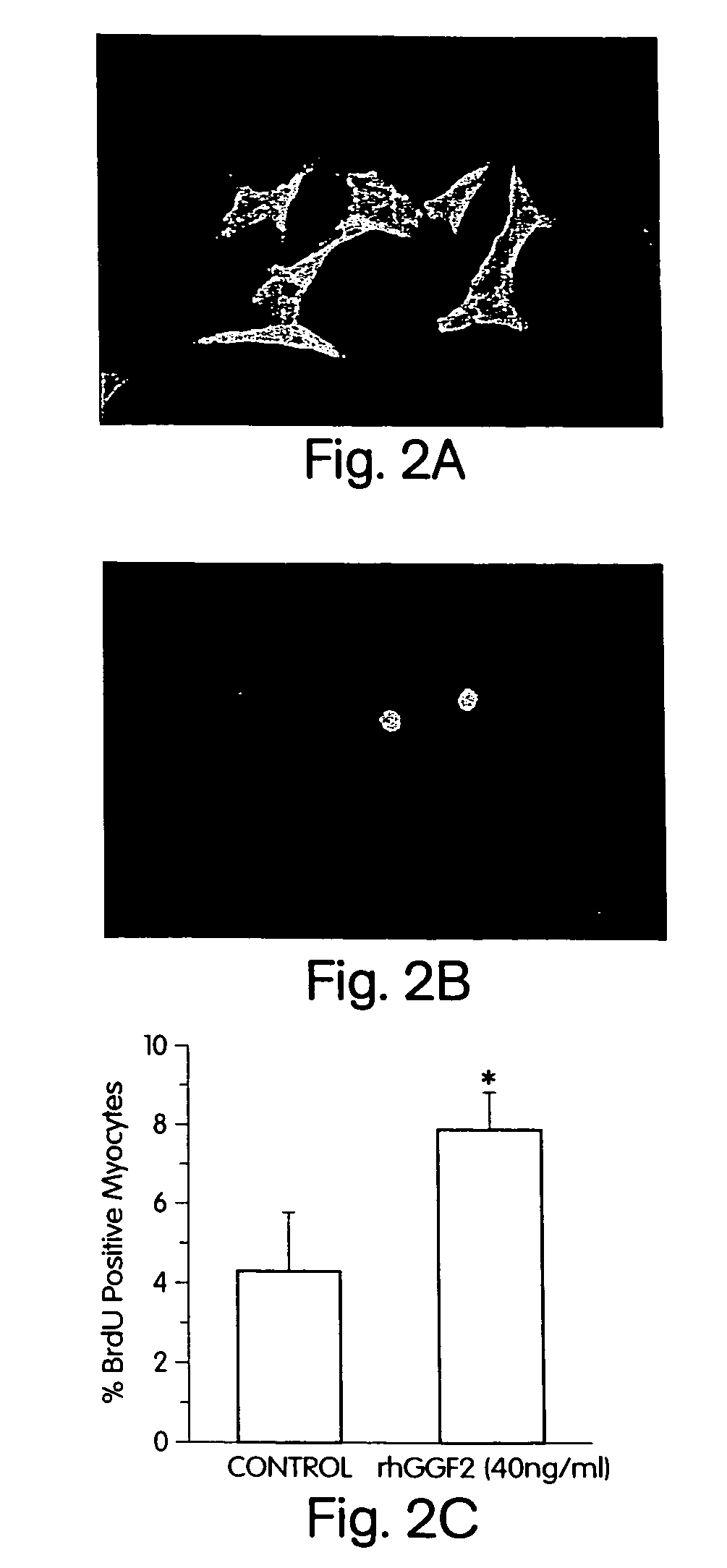 Methods for treating congestive heart failure