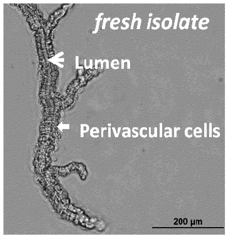 Methods and compositions to support tissue integration and inosculation of transplanted tissue and transplanted engineered penile tissue with adipose stromal cells