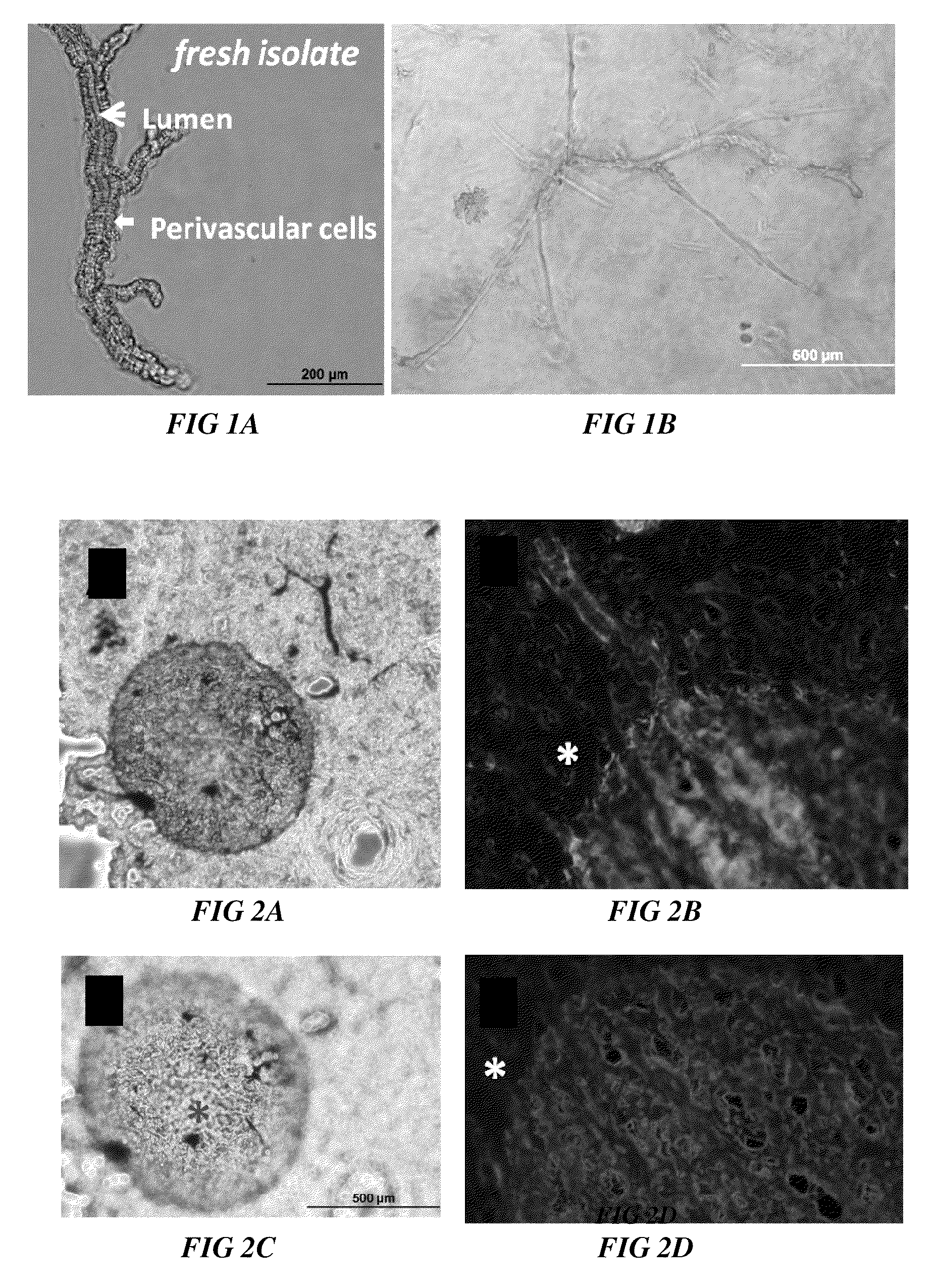 Methods and compositions to support tissue integration and inosculation of transplanted tissue and transplanted engineered penile tissue with adipose stromal cells